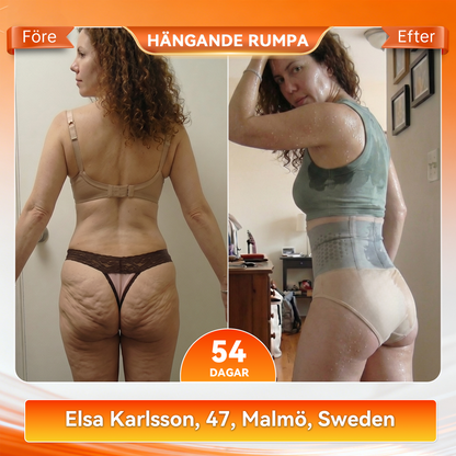 ShapeFit formande shorts • Synligt resultat